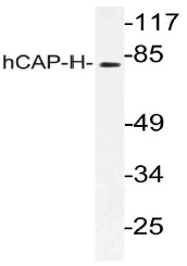 Western blot (WB) analysis of hCAP-H antibody (Cat.-No.: AP21157PU-N) in extracts from K562 cells.