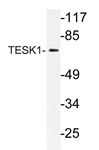 Western blot (WB) analysis of TESK1 antibody (Cat.-No.: AP21169PU-N) in extracts from rat liver cells.