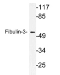 Western blot (WB) analysis of Fibulin-3 antibody (Cat.-No.: AP21171PU-N) in extracts from rat lung cells. Western blot (WB) analysis of Fibulin-3 antibody (Cat.-No.: AP21171PU-N) in extracts from rat lung cells.