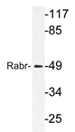Western blot (WB) analysis of Rabr antibody (Cat.-No.: AP21188PU-N) in extracts from MCF-7cells.