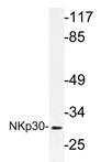 Western blot (WB) analysis of NKp30 antibody (Cat.-No.: AP21200PU-N) in extracts from A549 cells.