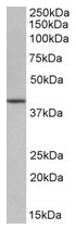 Goat anti Cholesterol oxidase antibody Cat.-No. R1075P (Lot 6534) was used to detect purified Cholesterol oxidase under reducing (R) and non-reducing (NR) conditions. Reduced samples of purified Cholesterol oxidase contained 4% BME and were boiled for 5 mi