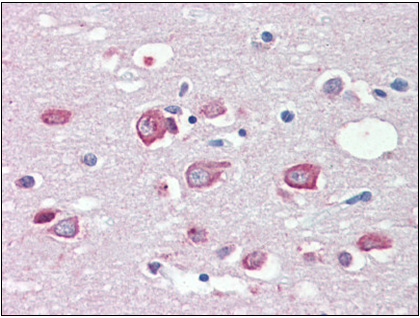 Human Brain, Cortex (formalin-fixed, paraffin-embedded) stained with MLL4 antibody followed by biotinylated anti-goat IgG secondary antibody, alkaline phosphatase-streptavidin and chromogen.