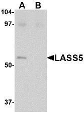 Western blot analysis of LASS5 in SK-N-SH lysate with LASS5 antibody (AP22658PU-N) at 1 ug/ml in the (A) absence and (B) presence of blocking peptide.