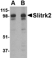 Western blot analysis of Slitrk2 in rat brain tissue lysate with Slitrk2 antibody (AP22670PU-N) at (A) 1 and (B) 2 ug/ml.