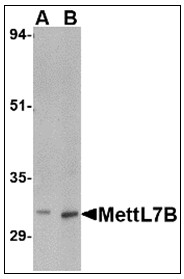 Western blot analysis of MettL7B in rat spleen tissue lysate with MettL7B antibody (AP22999PU-N) at (A) 2 and (B) 4 ug/ml