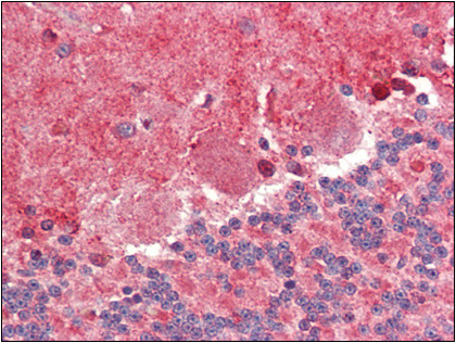 Goat anti Maltose Phosphorylase antibody Cat.-No. R1151P (lot 7850) was used to detect Maltose Phosphorylase under reducing (R) and non-reducing (NR) conditions. Reduced samples of purified target proteins contained 4% BME and were boiled for 5 minutes. Sa