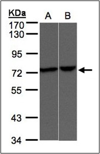Goat anti N-acylmanosamino-1-dehydrogenase antibody (Cat.-No. R1155P, lot 8181) was used to detect purified N-acylmanosamino-1-dehydrogenase under reducing (R) and non-reducing (NR) conditions. Reduced samples of purified target proteins contained 4% BME a