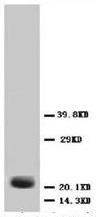 Figure. Immunoblot of Rub1 fusion protein. Anti-Rub1 antibody, generated by immunization with full-length recombinant yeast Rub1, was tested by immunoblot against a yeast cell lysate. A dilution of the antibody between 1:200 and 1:1,000 will show strong reactivity specifically with free Rub1 protein (indicated by arrow) and Rub1 conjugates. In this blot the antibody was used at a 1:500 dilution incubated overnight at 4°C in 5% non-fat dry milk in TTBS. Detection occurred using a 1:2000 dilution of HRP-labeled Donkey anti-Rabbit IgG for 1 hour at room temperature. A chemiluminescence system was used for signal detection (Roche). Other detection systems will yield similar results.