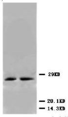 Figure 1. Immunoblot of Urm1 fusion protein: Anti-Urm1 antibody generated by immunization with recombinant yeast Urm1 was tested by immunoblot against yeast lysates expressing the Urm1-GFP fusion protein and other UBL fusion proteins. All UBLs possess limited homology to Ubiquitin and to each other, therefore it is important to know the degree of reactivity of each antibody against each UBL. Panel A shows total protein staining using ponceau. Panel B shows positions of free GFP or GFP containing recombinant proteins present in each lysate preparation after reaction with a 1:1,000 dilution of anti-GFP followed by reaction with a 1:15,000 dilution of HRP Donkey-a-Goat IgG. Panel C shows specific reaction with Urm1 using a 1:1,000 dilution of IgG fraction of Rabbit-anti-Urm1 (Yeast) followed by reaction with a 1:15,000 dilution of HRP Goat-a-Rabbit IgG. All primary antibodies were diluted in TTBS buffer supplemented with 5% non-fat milk and incubated with the membranes overnight at 4°C. Yeast lysate proteins were separated by SDS-PAGE using a 15% gel. This data indicates that anti-Urm1 is highly specific and does not cross react with other UBLs. Bands present in Panel C indicate that Urm1 and conjugated Urm1 is present in most yeast cell lysates albeit at significantly reduced levels relative to the Urm1-GFP transfected lysate. A chemiluminescence system was used for signal detection (Roche). Other detection systems will yield similar results. Data contributed by M. Malakhov, www.lifesensors.com, personal communication.