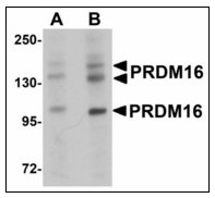 Western blot analysis of PRDM16 in rat brain tissue lysate with after heat-induced antigen retrieval at (A) 1 and (B) 2 ug/ml.