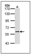 Sample (30 ug of whole cell lysate). A: NT2D1 B: IMR32 7.5% SDS PAGE ELP3 antibody ELP3 antibody diluted at 1/2000