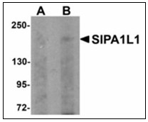 Western blot analysis of SIPA1L1 in rat brain tissue lysate with SIPA1L1 antibody at (A) 0.5 and (B) 1 ug/ml.