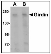 Western blot analysis of Girdin in rat brain tissue lysate with Girdin antibody at (A) 1 and (B) 2 ug/ml.