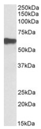 JARID2 staining of HeLa cells using a DyLight 488 conjugated secondary antibody.