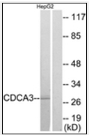 Western blot analysis of extracts from HepG2 cells, using CDCA3 Antibody. The lane on the right is treated with the synthesized peptide.