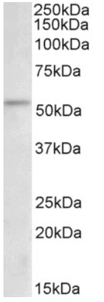 Immunohistochemical staining of Brain (Purkinje neurons) using anti-FZD9 antibody