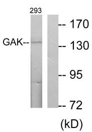 Western blot of extracts from 293 cells, using GAK Antibody. The lane on the right is treated with the synthesized peptide.