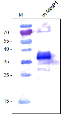 ELISA results using Seasonal H1N1 Nucleocapsid Protein antibody at 1ug/mL and the blocking and corresponding peptides at 60, 10, 2 and 0 ng/mL.