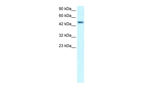 Human Lung; WB Suggested Anti-C5orf41 Antibody Titration: 0.2-1 ug/ml. Positive Control: Human Lung; C5orf41 antibody - middle region (AP42098PU-N) in Human Lung cells using Western Blot