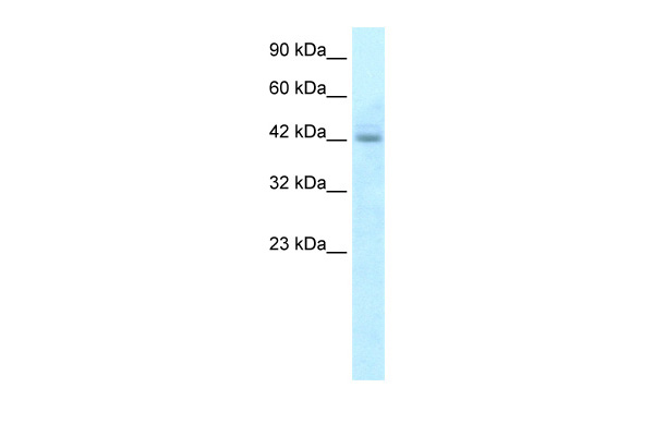 HEK293T cells were transfected with the pCMV6-ENTRY control (Left lane) or pCMV6-ENTRY DsRed-Monomer (Right lane) cDNA for 48 hrs and lysed. Equivalent amounts of cell lysates (5ug per lane) were separated by SDS-PAGE and immunoblotted with anti-DsRed-Monomer.