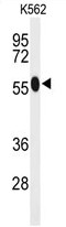 Western blot analysis of ACSM1 Antibody (N-term) in K562 cell line lysates (35ug/lane). ACSM1 (arrow) was detected using the purified Pab.