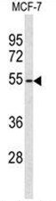 Western blot analysis of ADAMDEC1 Antibody (N-term) in MCF-7 cell line lysates (35 ug/lane). ADAMDEC1 (arrow) was detected using the purified Pab.