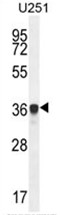 AMN1 Antibody (N-term) western blot analysis in U251 cell line lysates (35ug/lane).This demonstrates the AMN1 antibody detected the AMN1 protein (arrow).