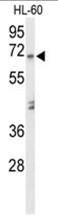 Western Blot: HIF-1 beta Antibody TA301442 - WB analysis of HIF-1 beta in MCF7 whole cell lysate.