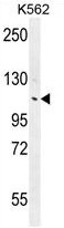 ANKRD18B Antibody (N-term) (Cat. #AP50184PU-N) western blot analysis in K562 cell line lysates (35g/lane).This demonstrates the ANKRD18B antibody detected the ANKRD18B protein (arrow).