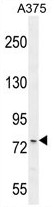 ANR44 Antibody (Center) western blot analysis in A375 cell line lysates (35ug/lane).This demonstrates the ANR44 antibody detected the ANR44 protein (arrow). ANR44 Antibody (Center) western blot analysis in A375 cell line lysates (35ug/lane).This demonstrates the ANR44 antibody detected the ANR44 protein (arrow).