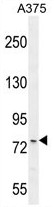 Western Blot: Eg5 Antibody TA301478 - Cells were transfected with the pCMV6-ENTRY control or pCMV6-ENTRY KIF11 cDNA for 48 hrs and lysed. Equivalent amounts of cell lysates (5ug per lane) were separated by SDS-PAGE and immunoblotted with anti-KIF11.