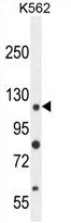 Detection of ATG5 in mouse wildtype ES cell lysate (Lane 1). Lane 2 is a mouse ATG5 KO ES cell lysate (negative control).