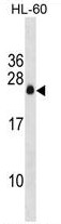 APRG1 Antibody (Center) western blot analysis in HL-60 cell line lysates (35ug/lane).This demonstrates the APRG1 antibody detected the APRG1 protein (arrow).