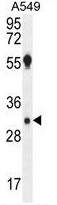 Western Blot: ABCF2 Antibody TA301507 - Analysis of ABCF2 on Lane 1: HeLa whole cell extracts and Lane 2: NIH/3T3 cell lysates using NB400-115.