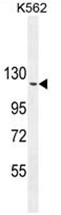 ARHGAP17 Antibody (N-term) western blot analysis in K562 cell line lysates (35ug/lane).This demonstrates the ARHGAP17 antibody detected the ARHGAP17 protein (arrow).