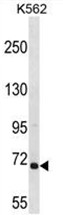 ARHGEF6 Antibody (C-term) western blot analysis in K562 cell line lysates (35ug/lane).This demonstrates the ARHGEF6 antibody detected the ARHGEF6 protein (arrow).