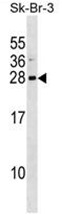 ARL1 Antibody (Center) western blot analysis in SK-BR-3 cell line lysates (35ug/lane).This demonstrates the ARL1 antibody detected the ARL1 protein (arrow).