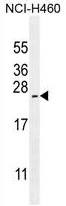 ARL17P1 Antibody (Center) western blot analysis in NCI-H460 cell line lysates (35ug/lane).This demonstrates the ARL17P1 antibody detected the ARL17P1 protein (arrow).