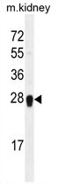 ARL5C Antibody (N-term) western blot analysis in mouse kidney tissue lysates (35ug/lane).This demonstrates the ARL5C antibody detected the ARL5C protein (arrow).