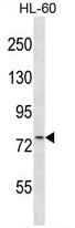 ARPP-21 Antibody (N-term) western blot analysis in HL-60 cell line lysates (35ug/lane).This demonstrates the ARPP-21 antibody detected the ARPP-21 protein (arrow).