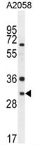 ARV1 Antibody (N-term) western blot analysis in A2058 cell line lysates (35ug/lane).This demonstrates the ARV1 antibody detected the ARV1 protein (arrow).