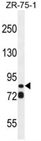 ASAP3 Antibody (N-term) western blot analysis in ZR-75-1 cell line lysates (35ug/lane).This demonstrates the ASAP3 antibody detected the ASAP3 protein (arrow).