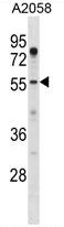 ASPSCR1 Antibody (N-term) western blot analysis in A2058 cell line lysates (35ug/lane).This demonstrates the ASPSCR1 antibody detected the ASPSCR1 protein (arrow).