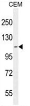 AT8B2 Antibody (N-term) western blot analysis in CEM cell line lysates (35ug/lane).This demonstrates the AT8B2 antibody detected the AT8B2 protein (arrow).