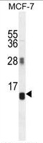 Western blot analysis of HSPA1A (arrow) using rabbit polyclonal HSPA1A Antibody (S41) (Cat.#TA302005).