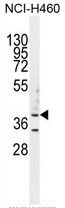 B3GALT5 Antibody (N-term) western blot analysis in NCI-H460 cell line lysates (35ug/lane).This demonstrates the B3GALT5 antibody detected the B3GALT5 protein (arrow).