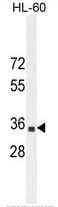 B3GNT4 Antaibody (Center) western blot analysis in HL-60 cell line lysates (35ug/lane).This demonstrates the B3GNT4 antibody detected the B3GNT4 protein (arrow).