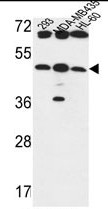 B3GNT5 Antibody (Center) western blot analysis in 293, MDA-MB435, HL-60 cell line lysates (35ug/lane).This demonstrates the B3GNT5 antibody detected the B3GNT5 protein (arrow).
