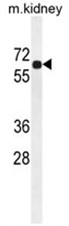 BCDO2 Antibody (N-term) western blot analysis in mouse kidney tissue lysates (35ug/lane).This demonstrates the BCDO2 antibody detected the BCDO2 protein (arrow).